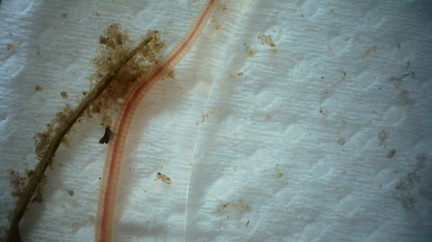 Freshwater worm